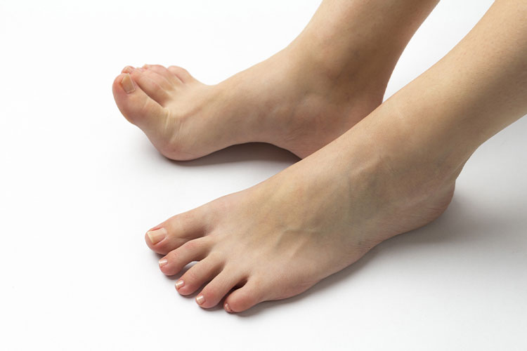 高尿酸血症（痛風）イメージ